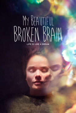 My Beautiful Broken Brain-hd